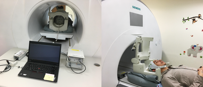 concurrent EEG and fMRI